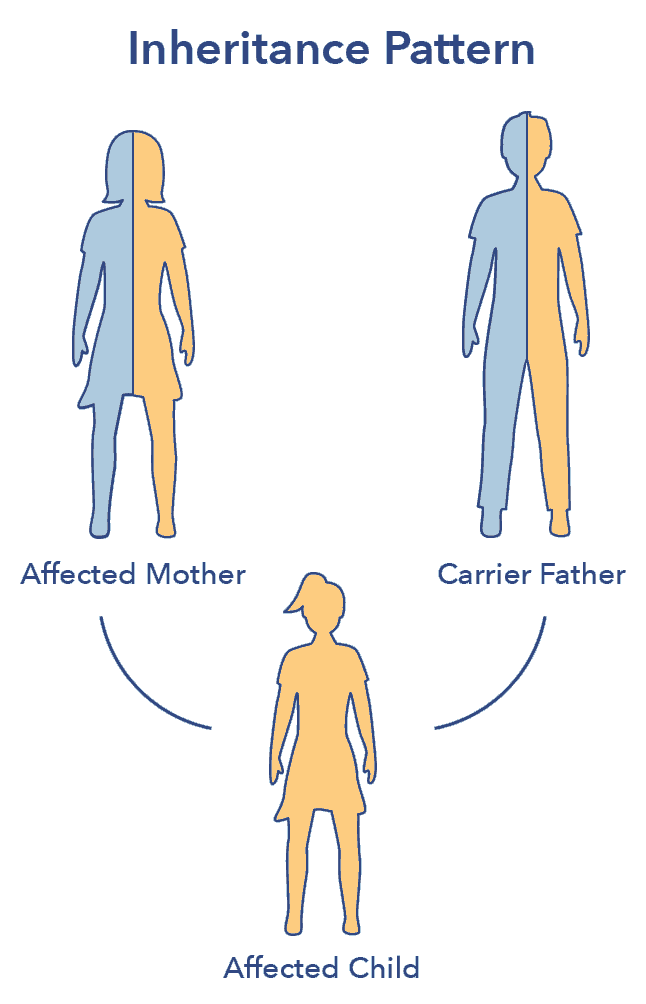 Uncovering The Genetics Of Sleep Paralysis Uncovering The Genetics Of Sleep Paralysis