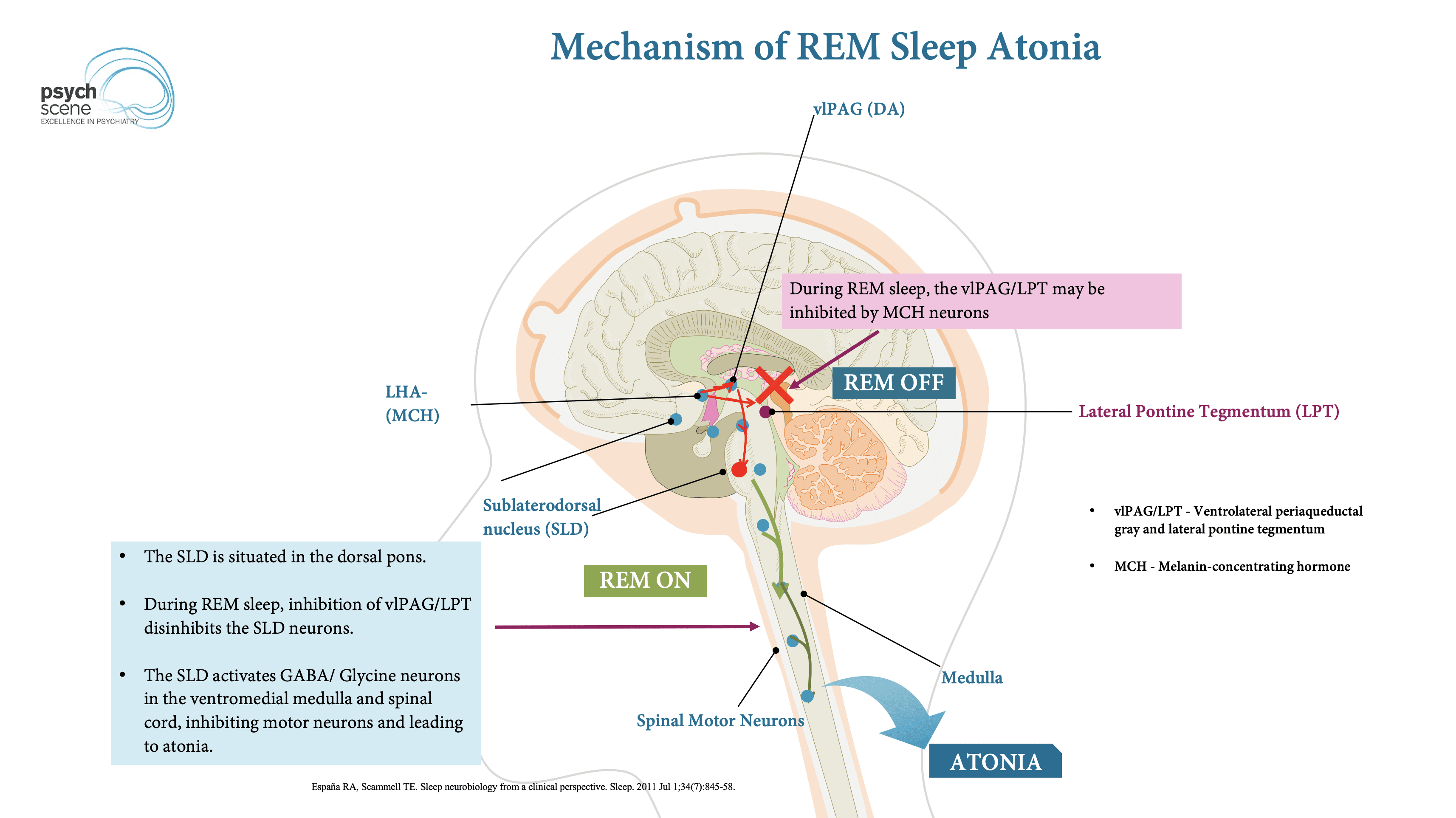Understanding The Neurobiological Mechanisms Of Sleep Paralysis