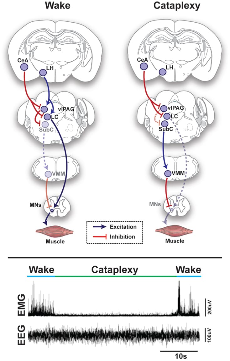 Understanding The Neurobiological Mechanisms Of Sleep Paralysis