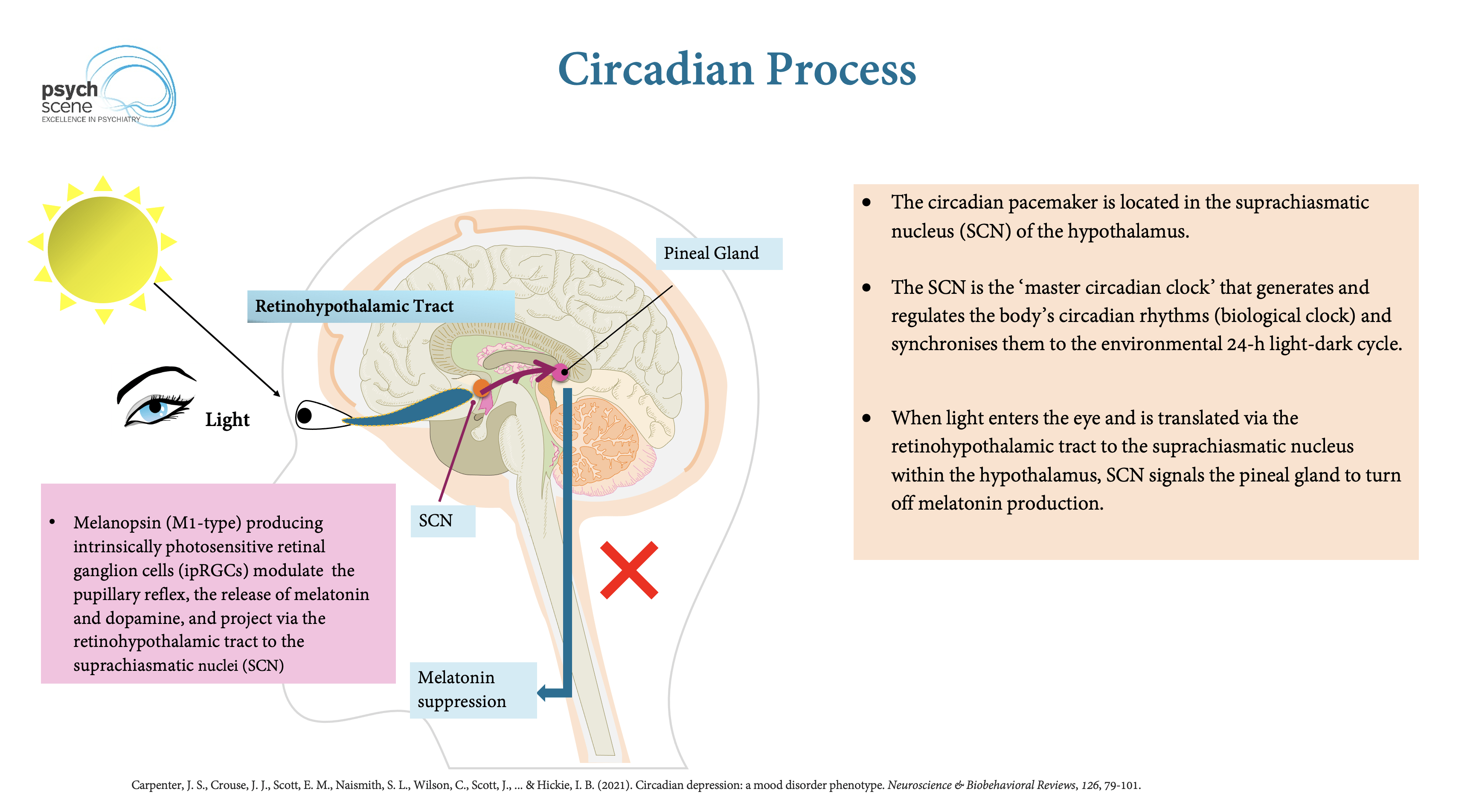 Understanding The Neurobiological Mechanisms Of Sleep Paralysis