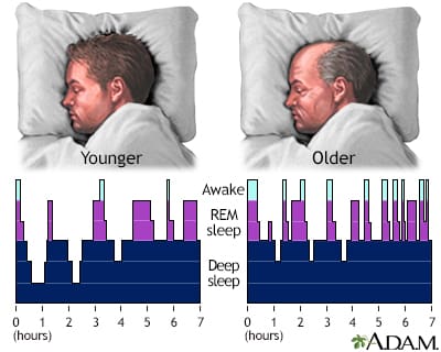 Can Sleep Paralysis Occur During Naps?