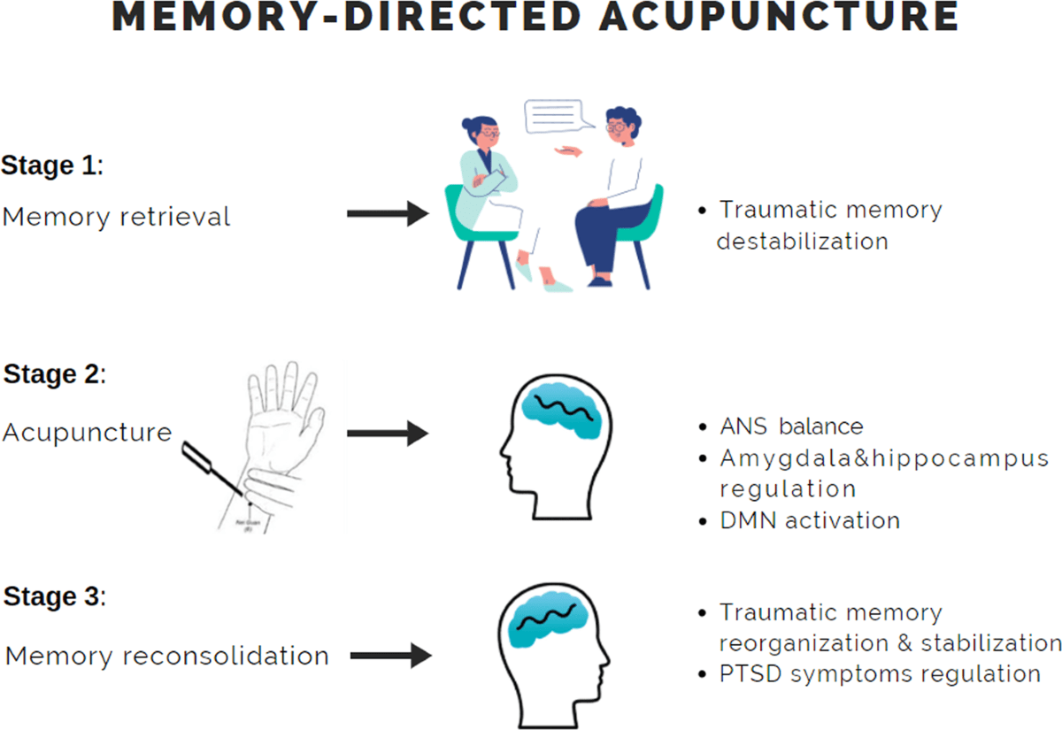 Exploring The Role Of Acupuncture And Acupressure In Managing Sleep Paralysis
